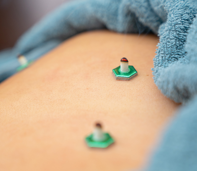 吉祥寺みやま鍼灸院