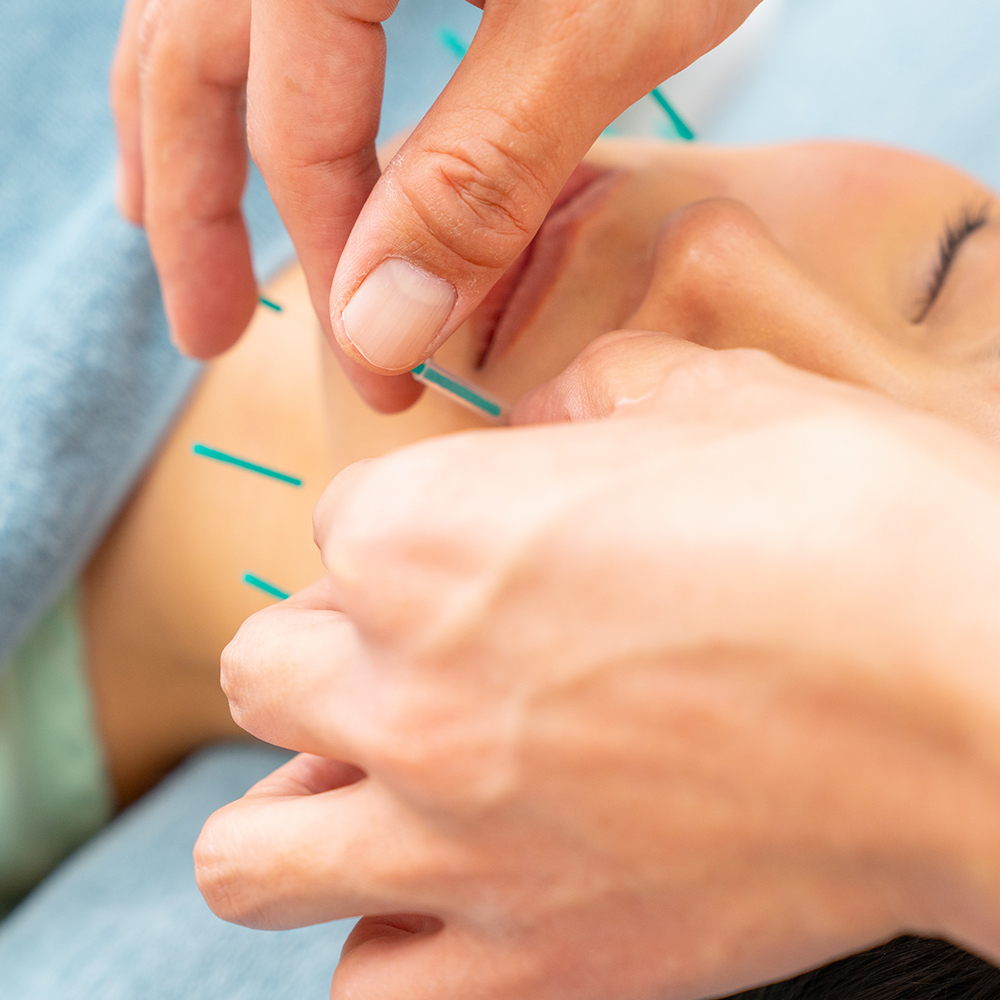 基本を大切にした鍼灸施術